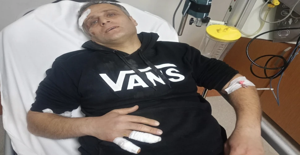 Araklı'da Scooter Aracıyla Kaza Yaptı Yaralandı