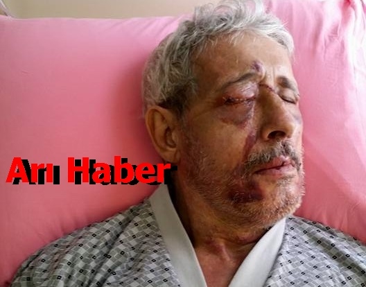 BOMBA GİBİ PATLADI