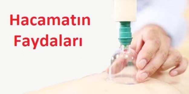Hacamat Tedavisi Artık Araklı\'da Yapılıyor